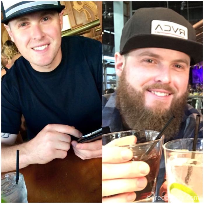 Before And After Beard