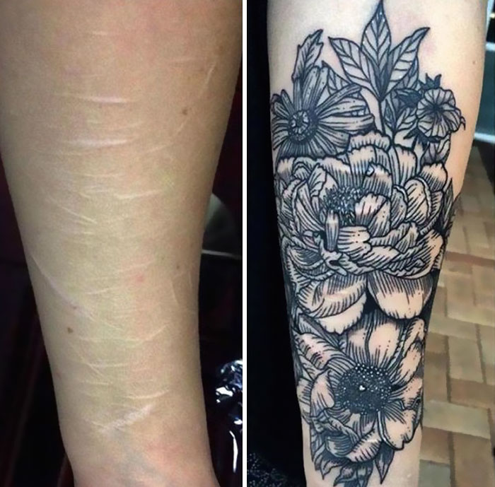 "Arm with self-harm scars before and after floral tattoo cover-up by tattoo artist. "Arm with self-harm scars before and after floral tattoo cover-up by tattoo artist.
