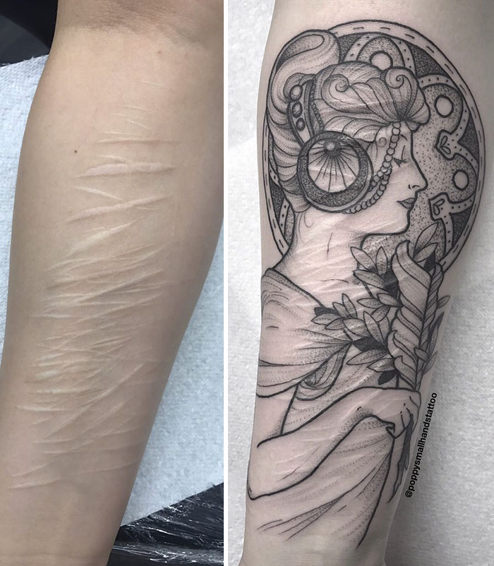 Tattoo artist covers self-harm scars with detailed art, showing before and after on the arm. Tattoo artist covers self-harm scars with detailed art, showing before and after on the arm.