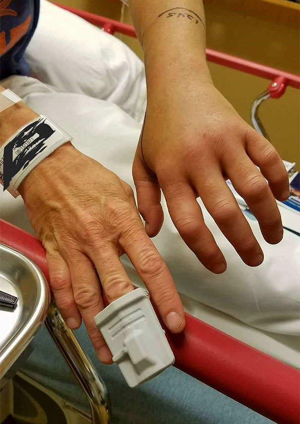 Want To Get Rid Of Wrinkles Fast? Just Get Bit By A Rattlesnake