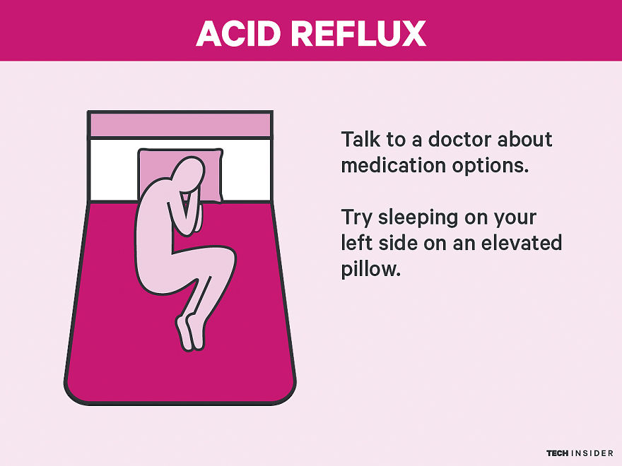 Sleep-Problems-Science-Fix-Illustrations