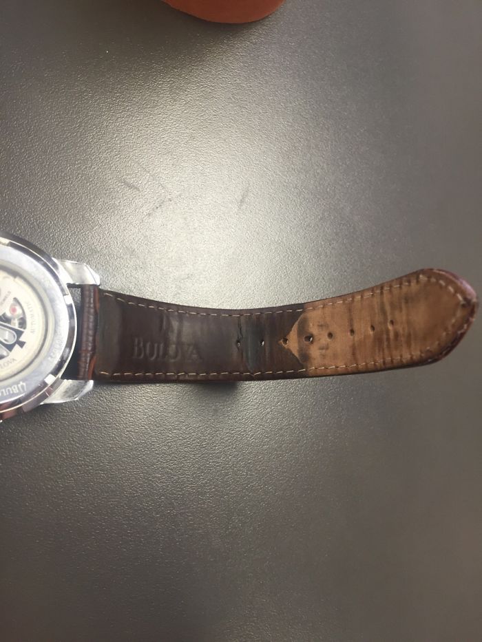 Where My Skin Has And Has Not Touched The Band Of My Watch Over The Last 2 Years