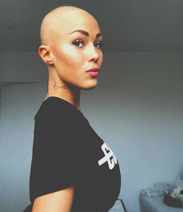 Woman Reveals Her 'Big Secret' She Was Hiding Under The Wig For Years, And Becomes A Model