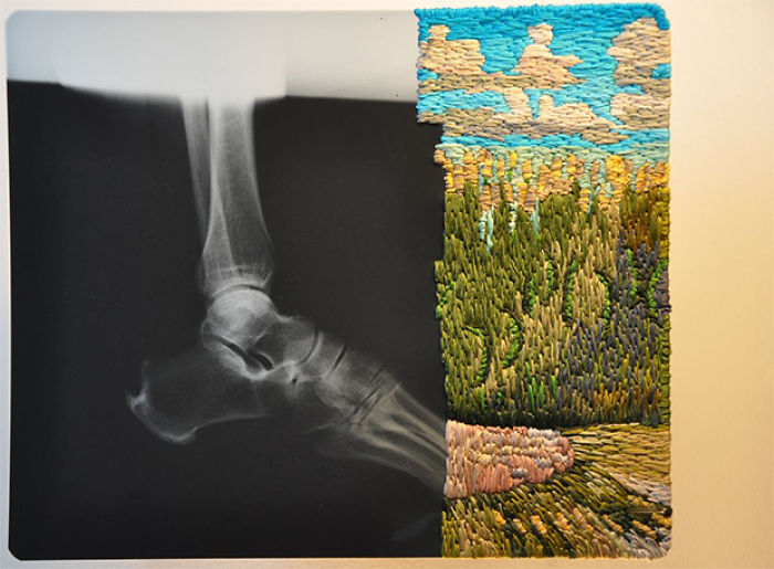This Artist Creates Incredible Boraddos On Medical X-Rays