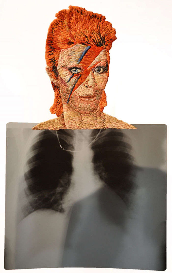 This Artist Creates Incredible Boraddos On Medical X-Rays