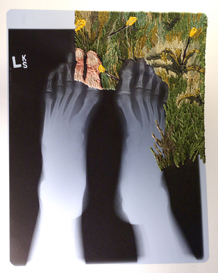 This Artist Creates Incredible Boraddos On Medical X-Rays