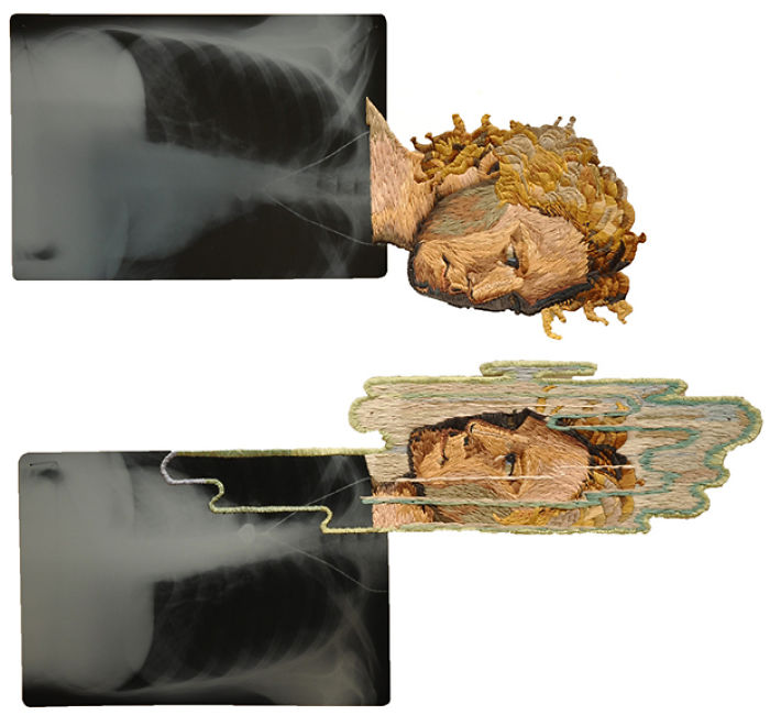 This Artist Creates Incredible Boraddos On Medical X-Rays