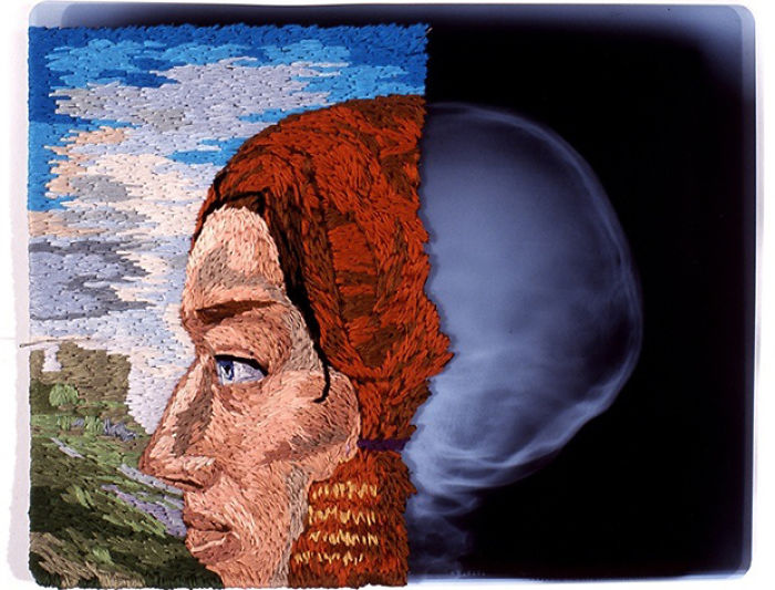 This Artist Creates Incredible Boraddos On Medical X-Rays