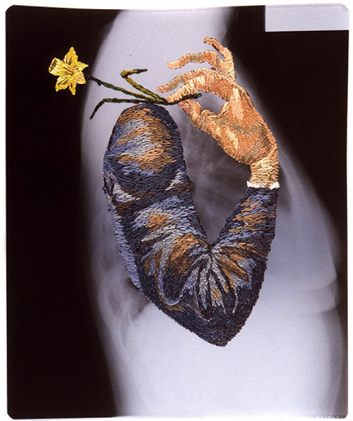 This Artist Creates Incredible Boraddos On Medical X-Rays