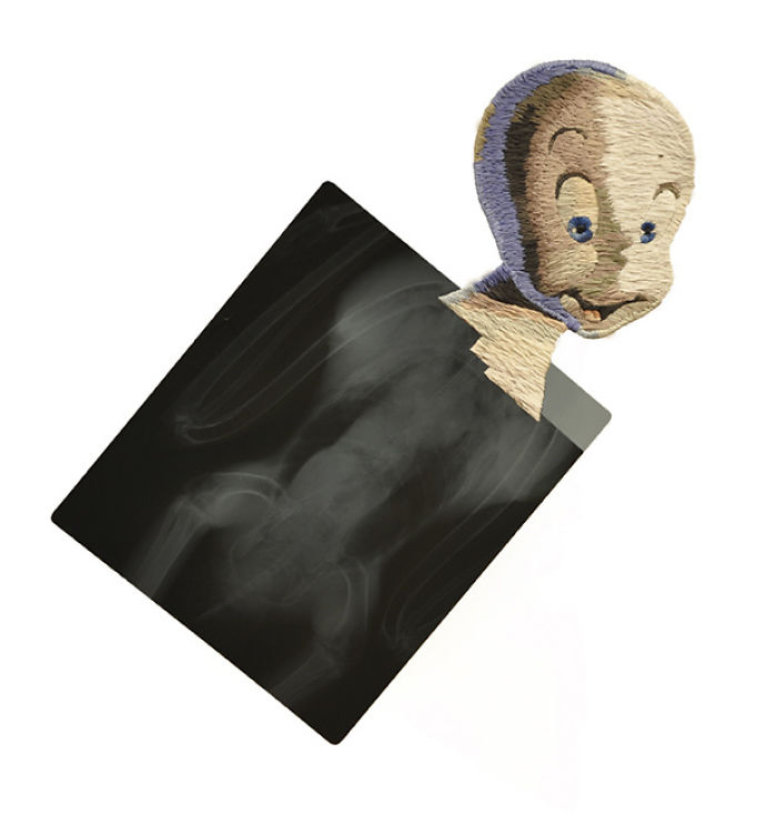 This Artist Creates Incredible Boraddos On Medical X-Rays