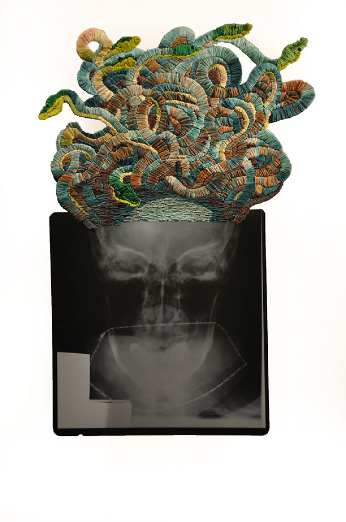 This Artist Creates Incredible Boraddos On Medical X-Rays