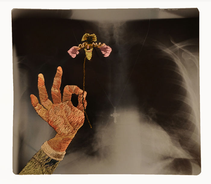This Artist Creates Incredible Boraddos On Medical X-Rays