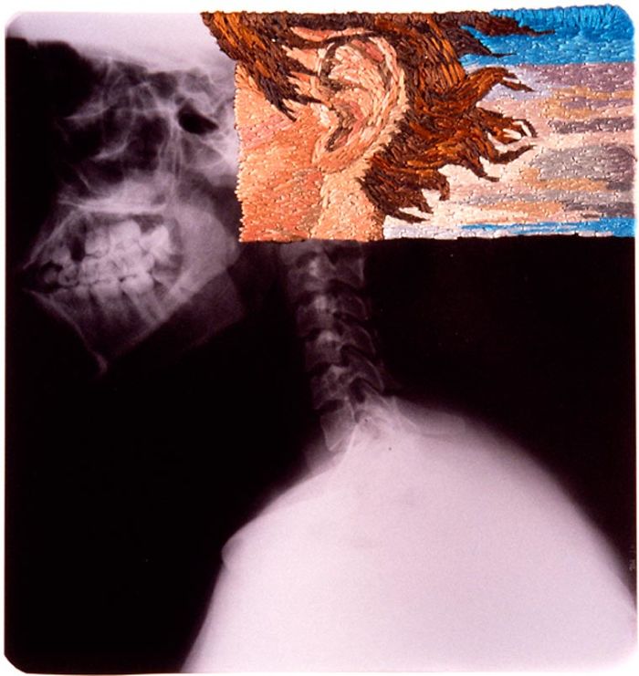 This Artist Creates Incredible Boraddos On Medical X-Rays