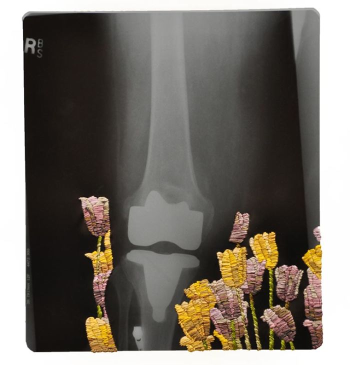 This Artist Creates Incredible Boraddos On Medical X-Rays