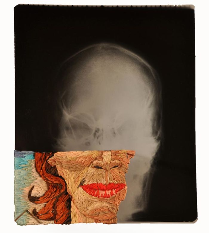 This Artist Creates Incredible Boraddos On Medical X-Rays