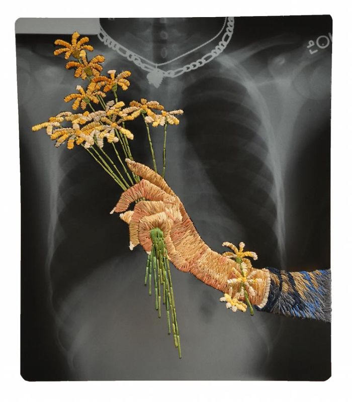 This Artist Creates Incredible Boraddos On Medical X-Rays