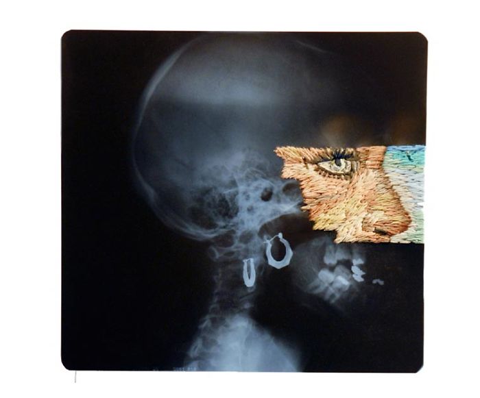 This Artist Creates Incredible Boraddos On Medical X-Rays