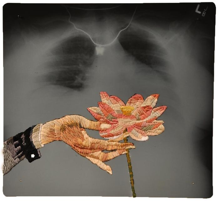 This Artist Creates Incredible Boraddos On Medical X-Rays