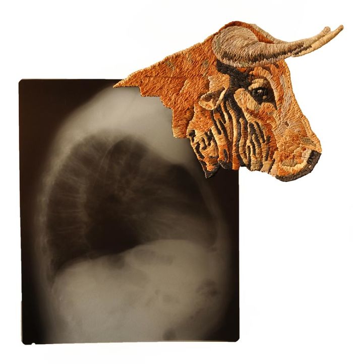 This Artist Creates Incredible Boraddos On Medical X-Rays