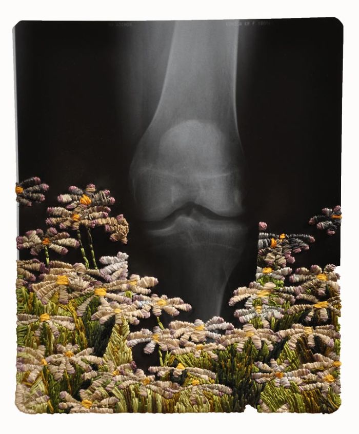 This Artist Creates Incredible Boraddos On Medical X-Rays
