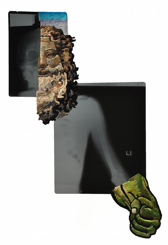 This Artist Creates Incredible Boraddos On Medical X-Rays