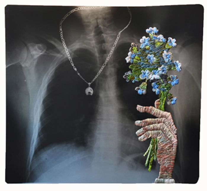 This Artist Creates Incredible Boraddos On Medical X-Rays