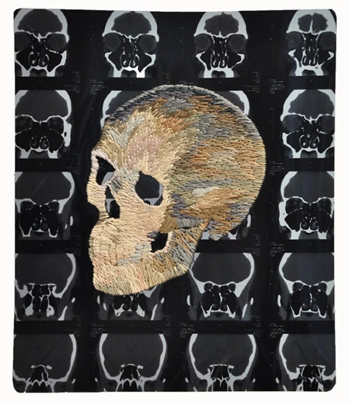 This Artist Creates Incredible Boraddos On Medical X-Rays