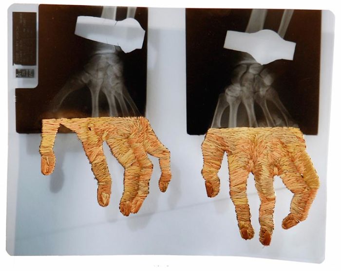 This Artist Creates Incredible Boraddos On Medical X-Rays