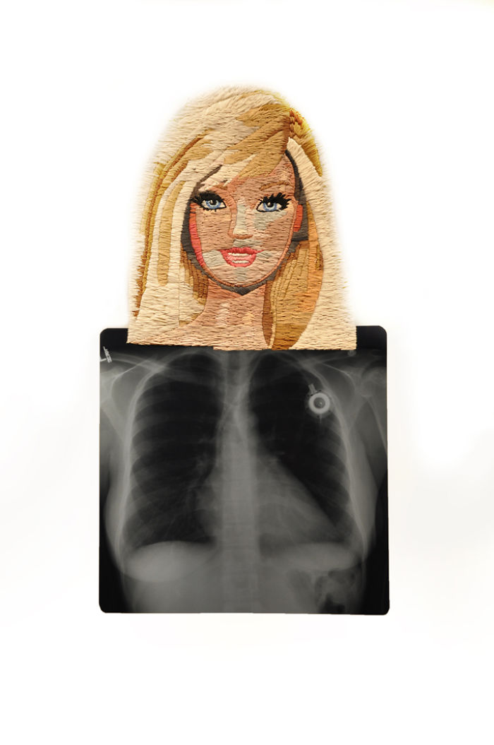This Artist Creates Incredible Boraddos On Medical X-Rays