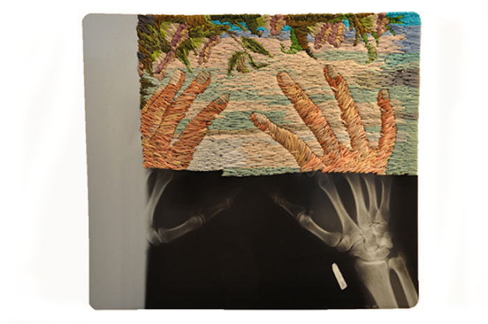 This Artist Creates Incredible Boraddos On Medical X-Rays