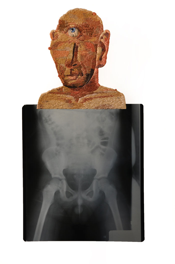 This Artist Creates Incredible Boraddos On Medical X-Rays