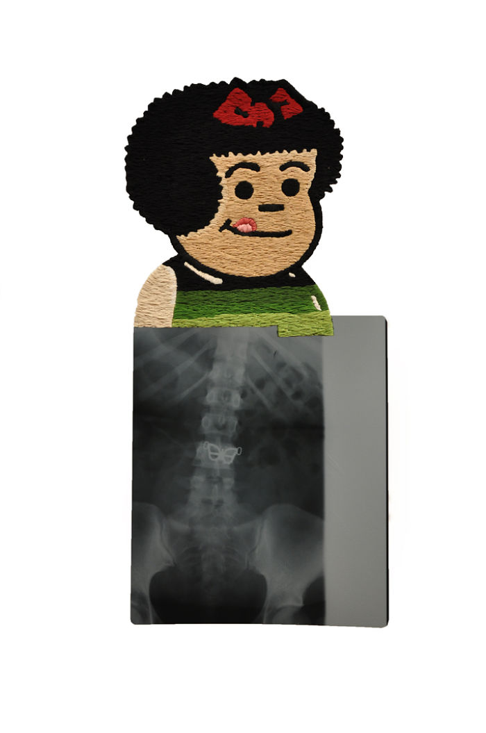 This Artist Creates Incredible Boraddos On Medical X-Rays