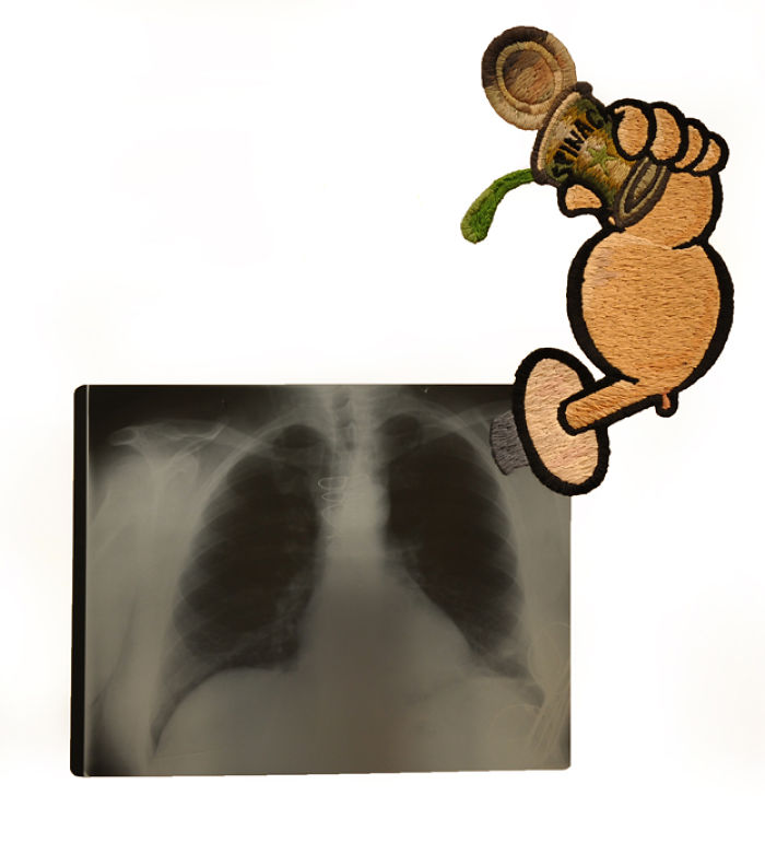 This Artist Creates Incredible Boraddos On Medical X-Rays