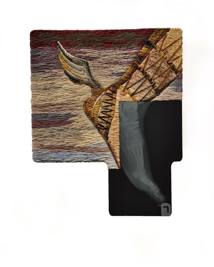 This Artist Creates Incredible Boraddos On Medical X-Rays