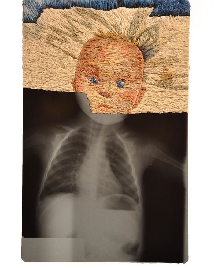 This Artist Creates Incredible Boraddos On Medical X-Rays