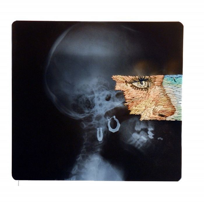 This Artist Creates Incredible Boraddos On Medical X-Rays