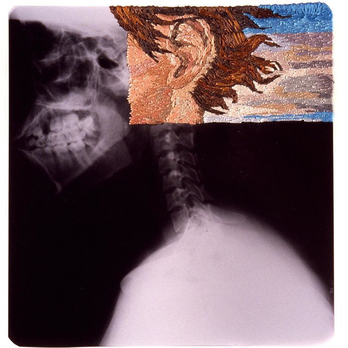 This Artist Creates Incredible Boraddos On Medical X-Rays