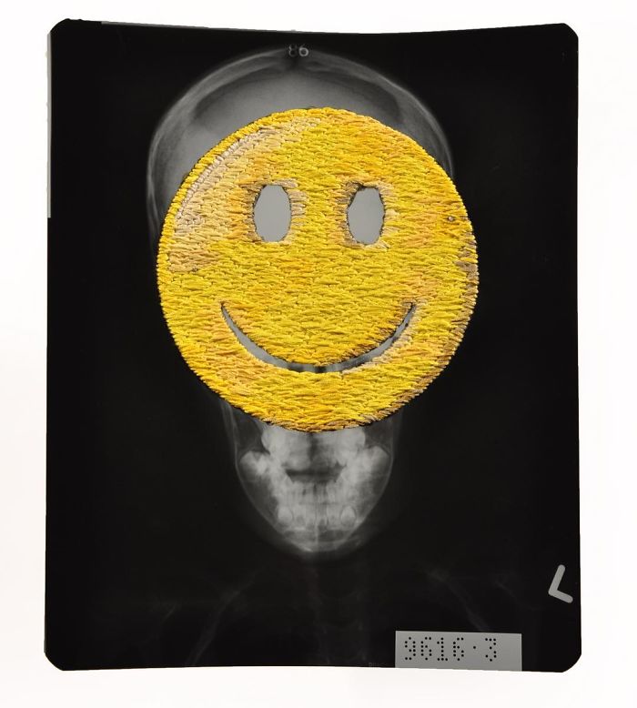 This Artist Creates Incredible Boraddos On Medical X-Rays