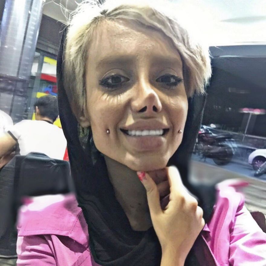 Woman Does 50 Plastic Surgeries To Stay The Same Angelina Jolie And Has A Negative Return On The Internet