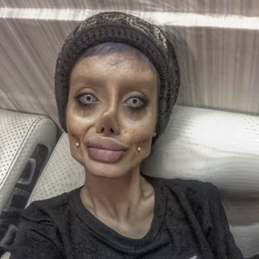 Woman Does 50 Plastic Surgeries To Stay The Same Angelina Jolie And Has A Negative Return On The Internet