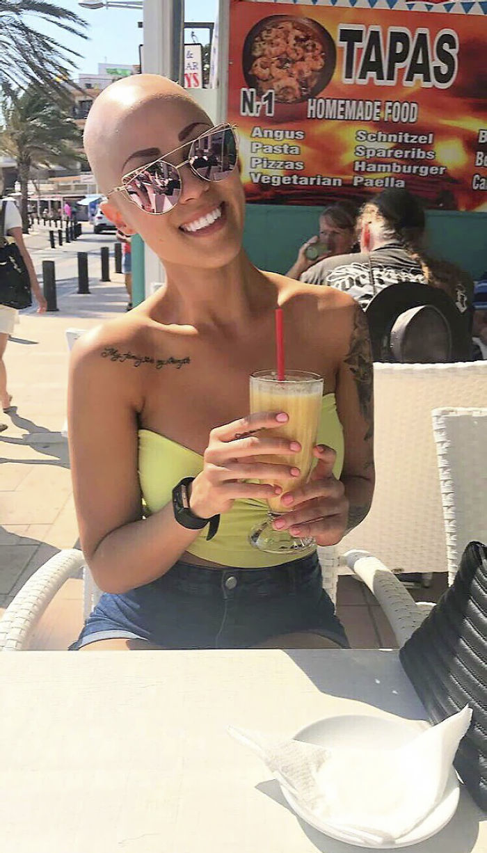 Woman Reveals Her 'Big Secret' She Was Hiding Under The Wig For Years, And Becomes A Model