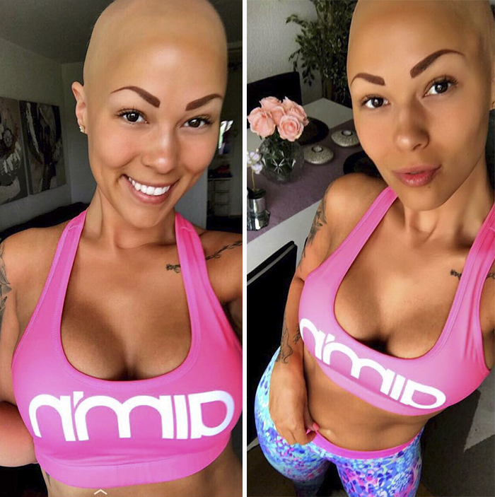 Woman Reveals Her 'Big Secret' She Was Hiding Under The Wig For Years, And Becomes A Model