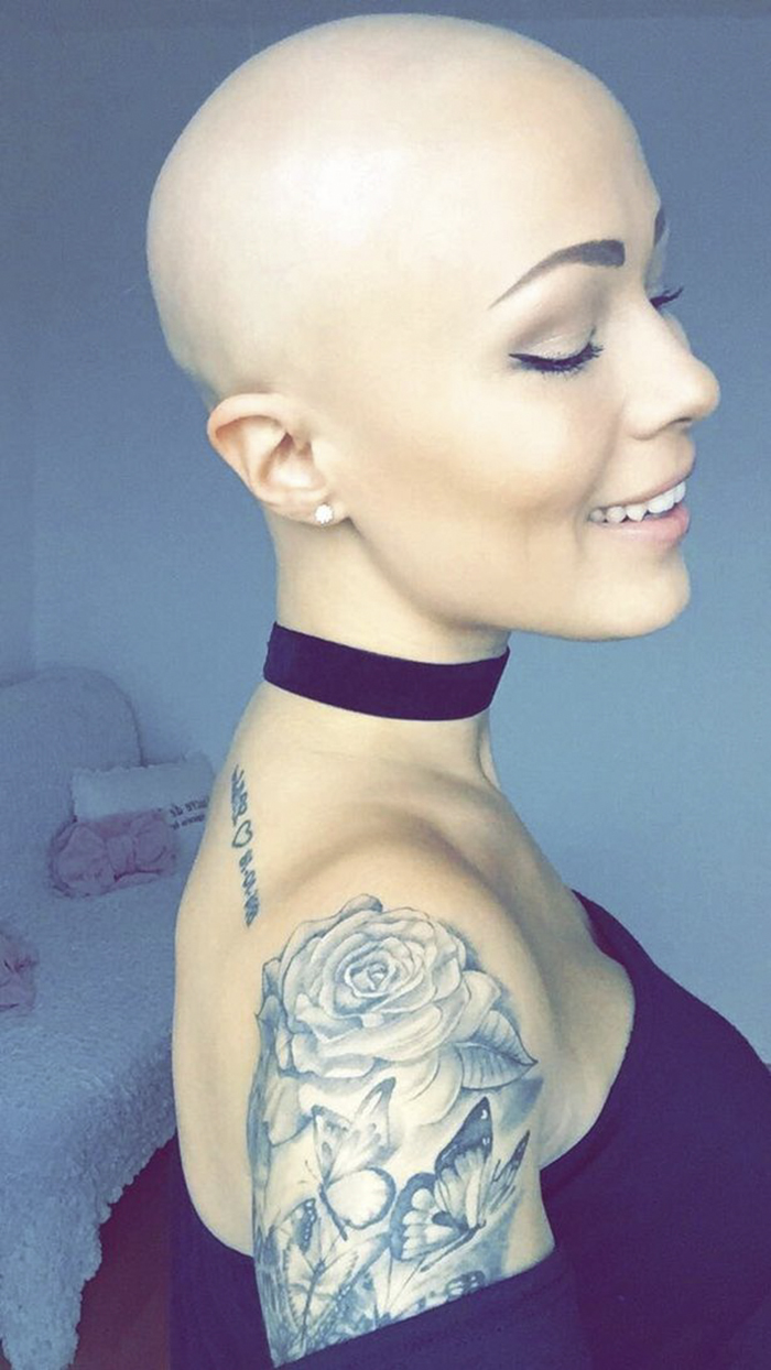 Woman Reveals Her 'Big Secret' She Was Hiding Under The Wig For Years, And Becomes A Model