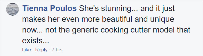 Woman Reveals Her 'Big Secret' She Was Hiding Under The Wig For Years, And Becomes A Model