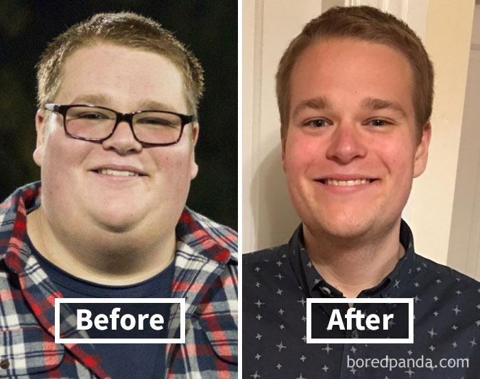 Before and after photos showing face fat loss in a weight loss journey.