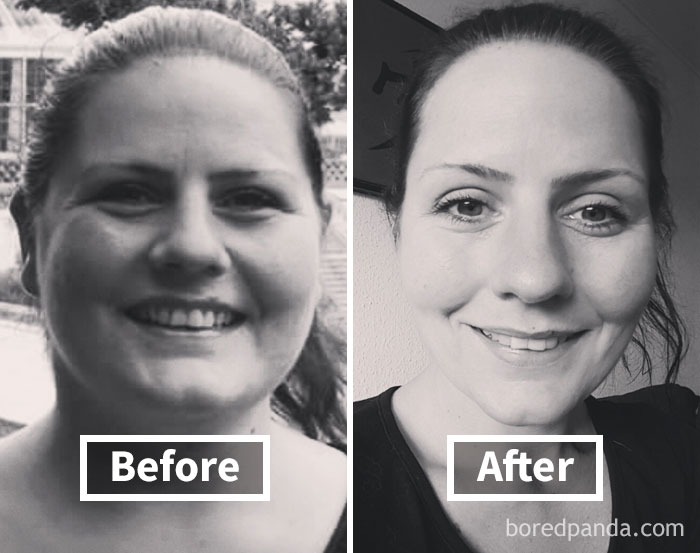 Before and after photos showing face fat loss transformation.