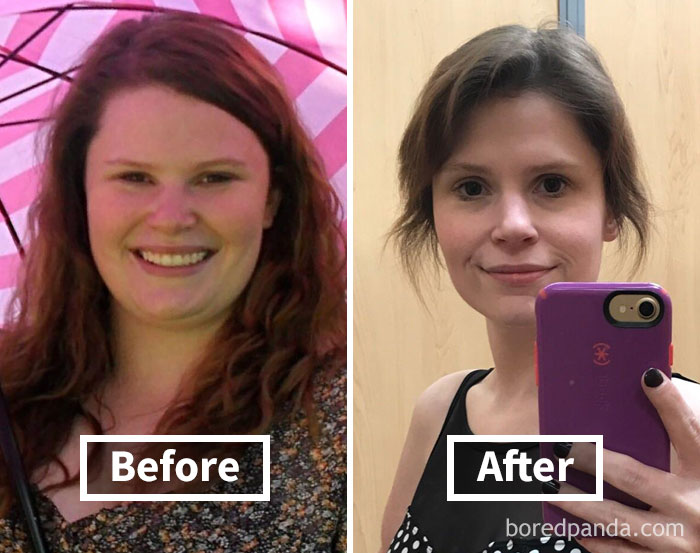 Face fat loss transformation with before and after photos.