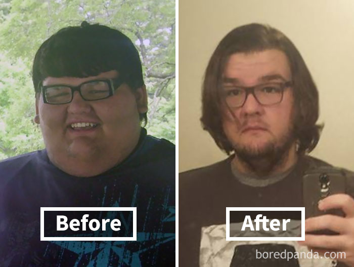 Before and after photos showing face fat loss, highlighting weight loss transformation.