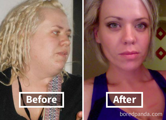 Before and after face fat loss transformation.
