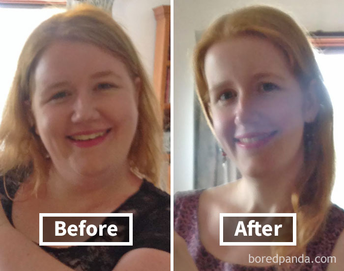 Face fat loss transformation: before and after weight loss with visible changes in facial features and skin tone.